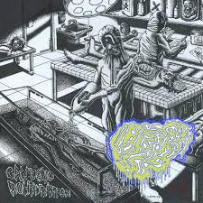 Fetal Deformity : Cadaveric Rehydration